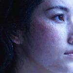 Revolutionary Breakthroughs: How Krystal Biotech is Tackling Rare Skin Diseases with Cutting-Edge Gene Therapy